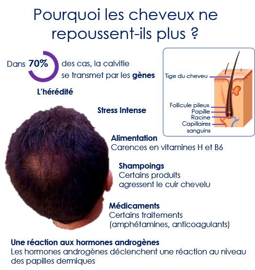 , Traitement de l’alopécie, Centre Laser Paris Sorbonne : Soins Esthétiques &amp; Dermatologie