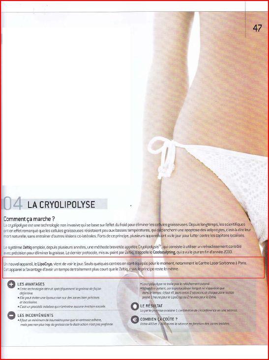 , LipoCryo dans &#8220;Perfect Beauty&#8221;, Centre Laser Paris Sorbonne : Soins Esthétiques &amp; Dermatologie