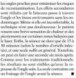 , Mycoses des ongles : Un article dans Femme Actuelle, Centre Laser Paris Sorbonne : Soins Esthétiques &amp; Dermatologie